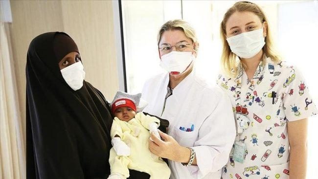 Somali parasitic twin