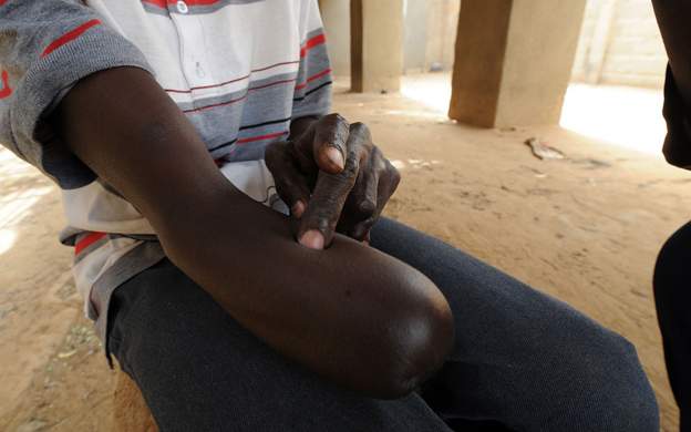 Mali amputations by suspected jihadists condemned