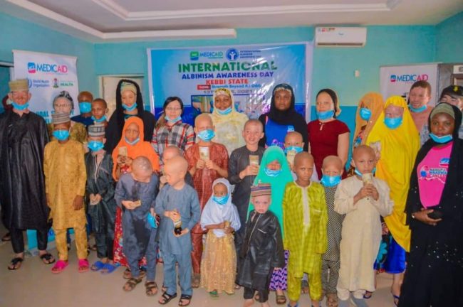 Dr. Bagudu to Nigerians: Love persons living with albinism, help them ward off skin cancer