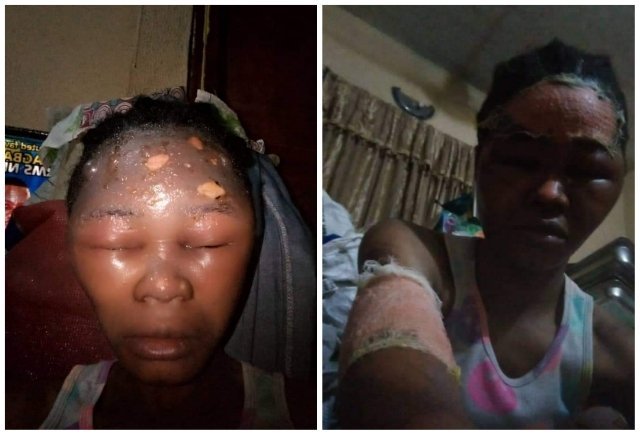Lagos to prosecute employer over assault on sales lady