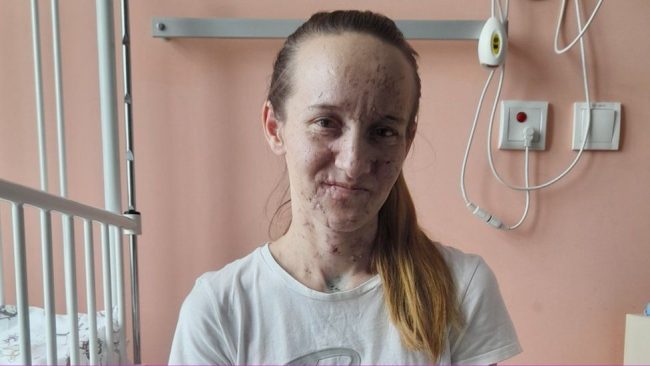 Polish doctor saves family's sight after bombing