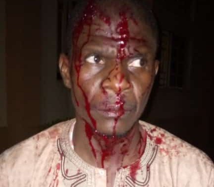 NMA demands justice over attack on medical officer in Bauchi