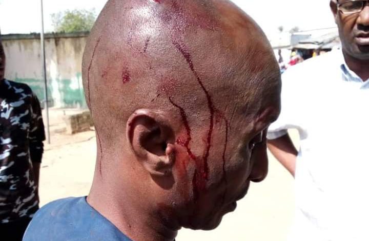 NSCDC operative, hunters beat senior police officer in Bauchi