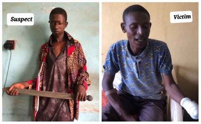Police arrest 15-year-old herder for amputating farmer's hand